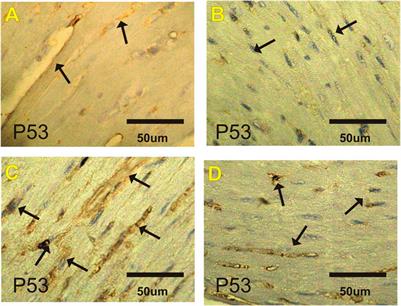 Therapeutic Impact of Costus (Saussurea lappa) Against Ehrlich Solid Tumor-Induced Cardiac Toxicity and DNA Damage in Female Mice